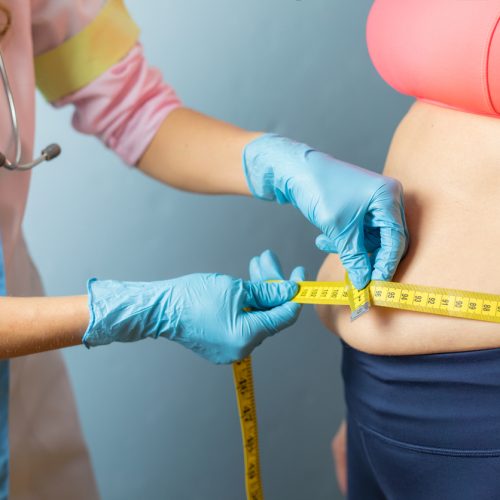 Therapist taking obese woman's body waist measurements